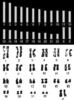Chromosomes - Human Female Karyotype