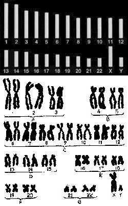 Chromosomes - Human Male Karyotype